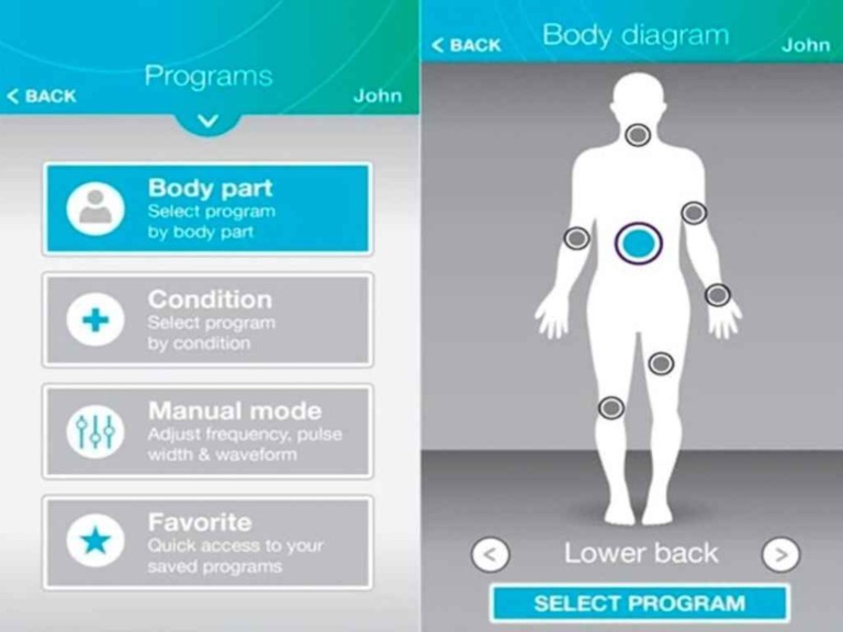 Pelvic Floor Tens Machine Placement Guide Itens Australia Tens Au