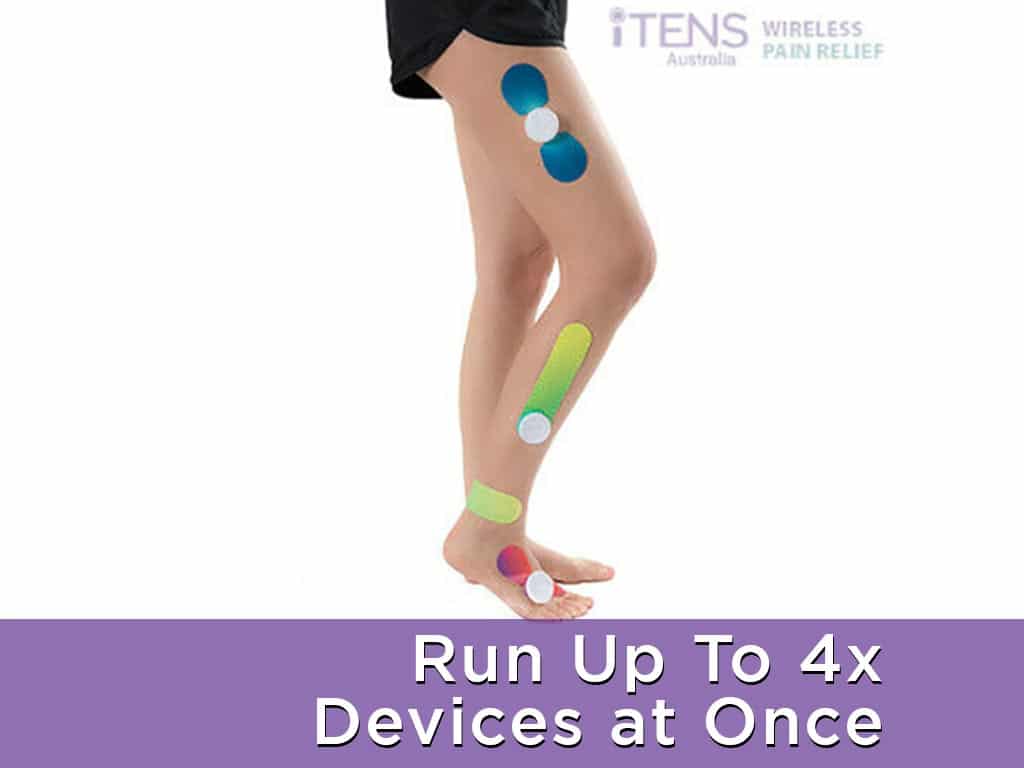 A woman employing four iTENS devices, spanning from her thigh to her feet