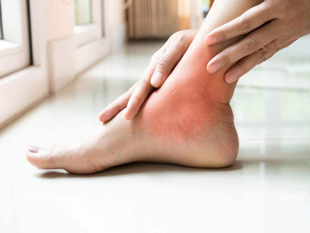 A woman with irritated skin on her foot and ankle